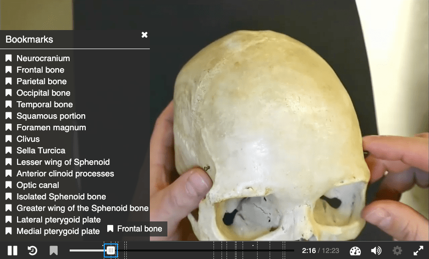 Video of a skull with bookmarks for anatomical features