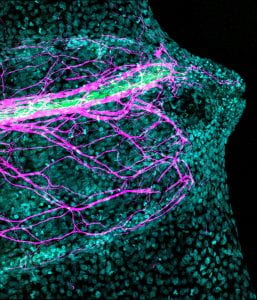 Brightfield image of the X. tropicalis tadpole head. Green fluorescence represents GFP encoded by mRNA injected into the neural lineage, labeling the brain, spinal cord and optic nerves.
